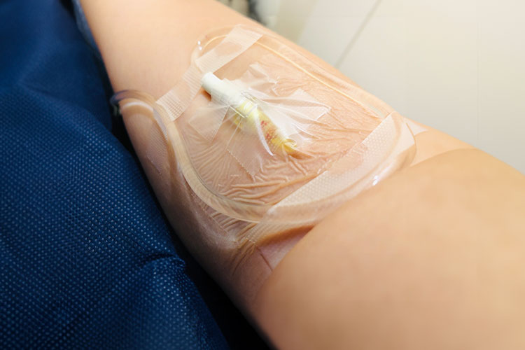 痛みや苦しさの少ない内視鏡検査