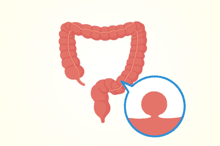 日帰り大腸ポリープ手術